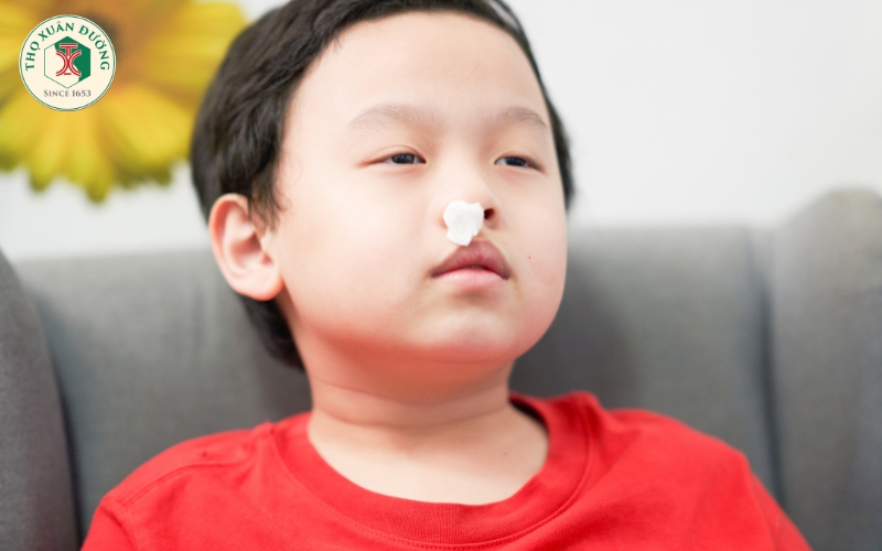 Chảy máu cam: Dấu hiệu thường gặp hay bệnh lý nguy hiểm?