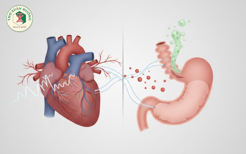 Mối liên quan giữa rung nhĩ và bệnh trào ngược dạ dày thực quản